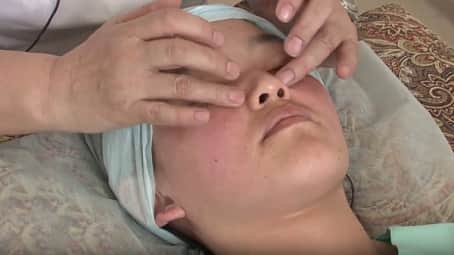 Тейпирование лица